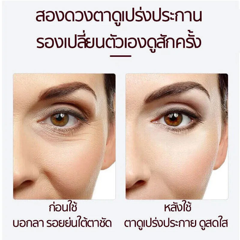 ຄຣີມບຳລຸງຜິວຕາ 20 ກຣາມ, ຄຣີມບຳລຸງຜິວຕາ, ຄຣີມບຳລຸງຜິວຕາ, ຄຣີມບຳລຸງຜິວຕາ, ອາຍໄລເນີສີດຳ, ຄຣີມບຳລຸງຜິວຕາ ...