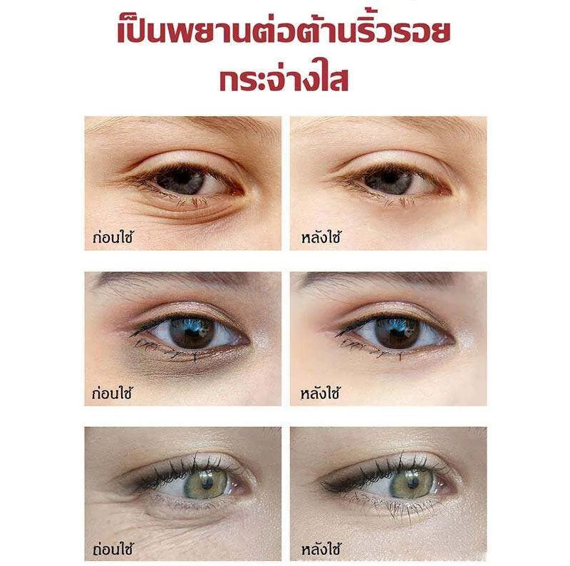 ຄຣີມບຳລຸງຜິວຕາ 20 ກຣາມ, ຄຣີມບຳລຸງຜິວຕາ, ຄຣີມບຳລຸງຜິວຕາ, ຄຣີມບຳລຸງຜິວຕາ, ອາຍໄລເນີສີດຳ, ຄຣີມບຳລຸງຜິວຕາ ...